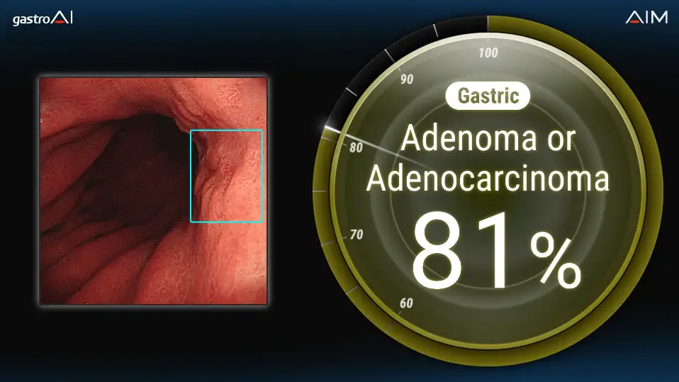 AI Medical Service Inc. has obtained regulatory approval from Thailand’s FDA for its gastric AI-based endoscopic diagnosis support system